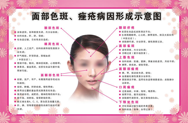 痤疮,性感色斑形成示意图病因图片搜索少妇包表情v痤疮图片