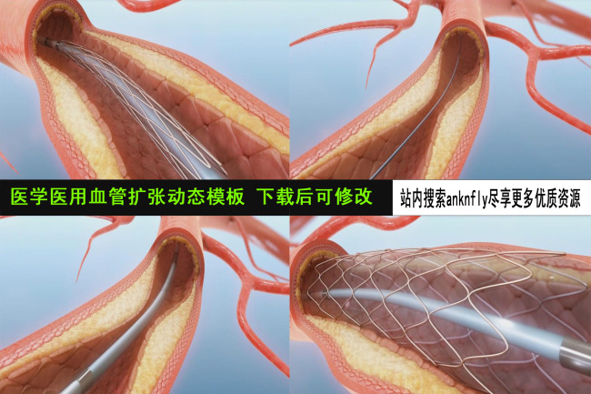 医学医用血管扩张动态AE模板模板下载(图片编号:11224739)_After-Effects 源文件_视频素材|AE模版|片头片尾_我图网weili.ooopic.com