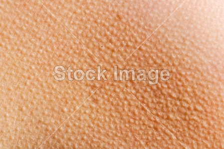 起鸡皮疙瘩皮肤背景图片素材(图片编号:50747