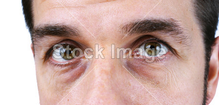 很累眼睛的男人图片素材(图片编号:50818979