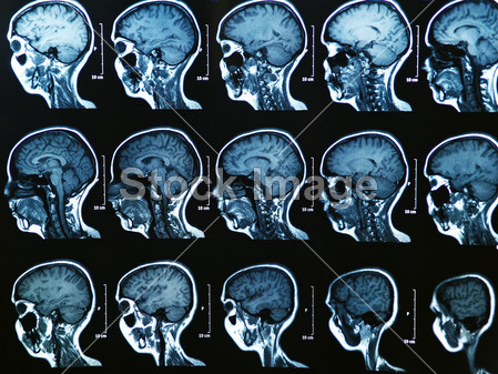 磁共振成像大脑扫描图片素材(图片编号:50833