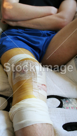 损伤膝关节绷带图片素材(图片编号:50854441